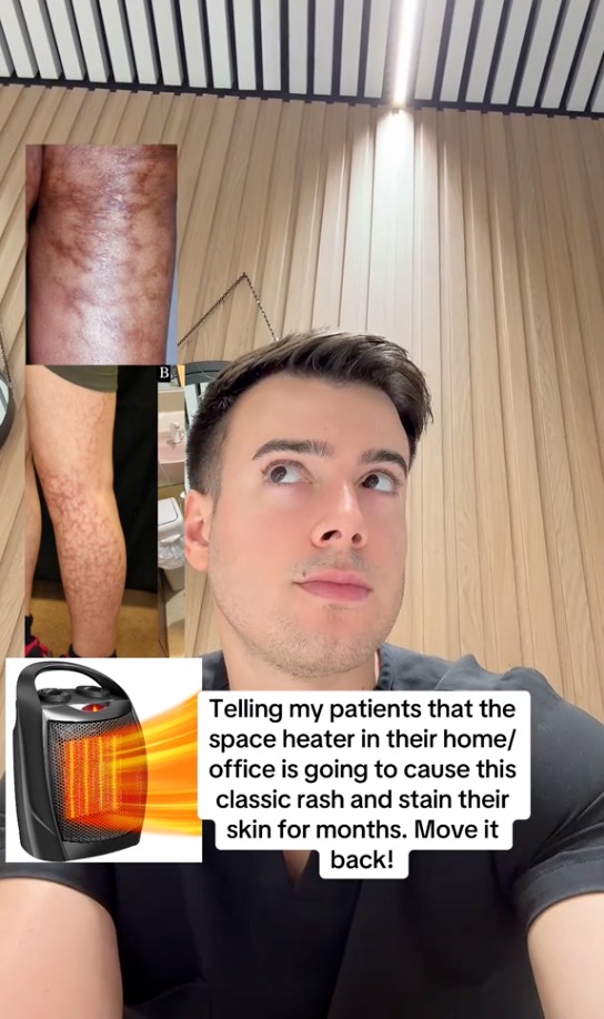 NYC dermatologist Charles Puza is sharing a very troubling concern about space heaters — they can cause a condition called erythema ab igne, also known as "dry skin syndrome."